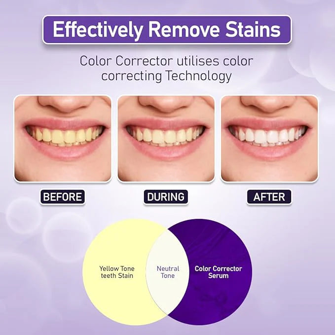 HiSmile V34 Teeth Whitening Serum | Original